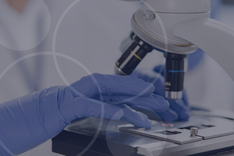 Unrecognizable lab worker inspecting blood sample under microsco